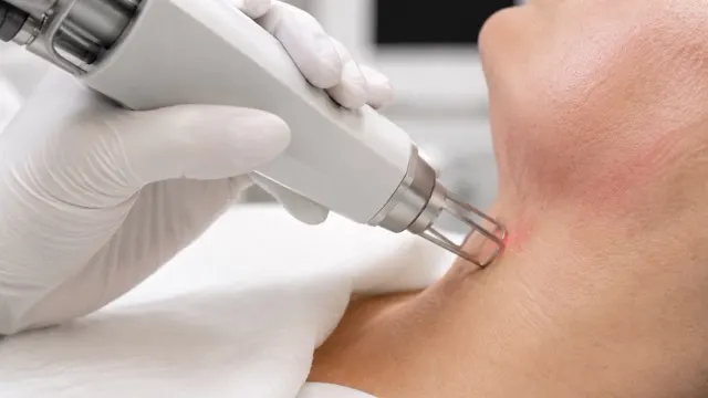 A gloved practitioner holding a laser handpiece against a client's neck, the treated skin showing slight flushing